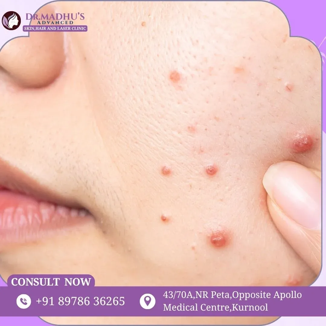 Medical Dermatology