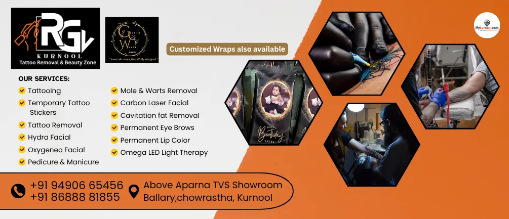 RGV tattoo removal